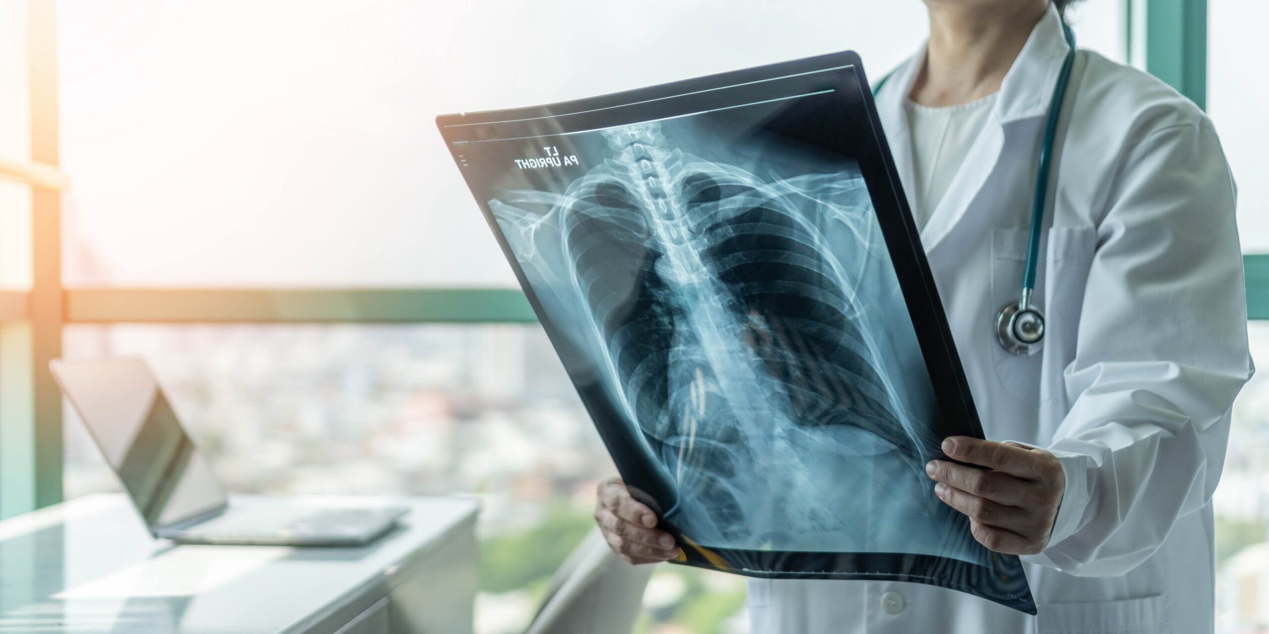 Doctor,Diagnosing,Patient‚Äôs,Health,On,Asthma,,Lung,Disease,,Covid-19,,Coronavirus Doctor diagnosing patient’s health on asthma, lung disease, COVID-19, coronavirus or bone cancer illness with radiological chest x-ray film for medical healthcare hospital service